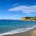 dialysis in Italy